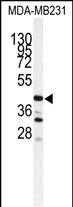 WB - CTSS Antibody (Center) AP7382c